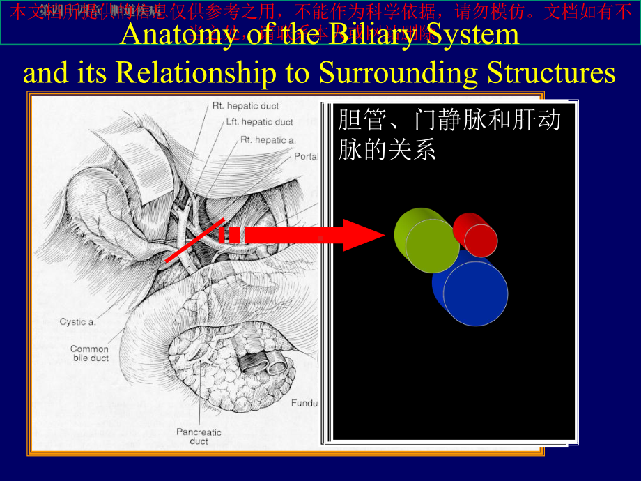 胆道疾病双语幻灯培训课件.ppt_第3页