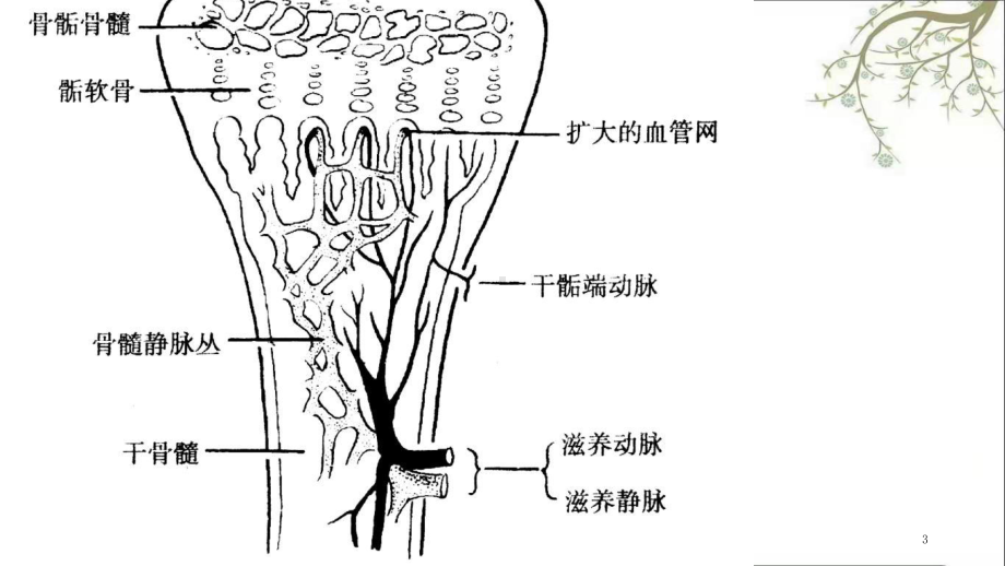 化脓性骨髓炎课件1.ppt_第3页