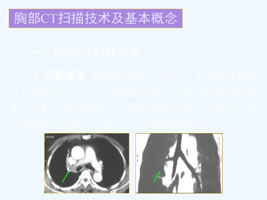 胸部正常CT读片课件.ppt_第3页