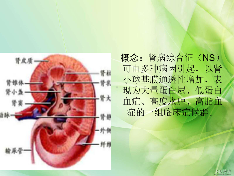 肾病综合征课件-2.pptx_第3页