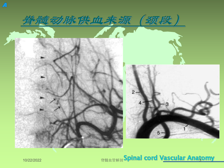 脊髓血管解剖培训课件.ppt_第3页