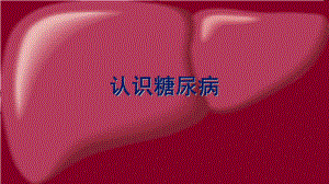 认识糖尿病-课件.ppt