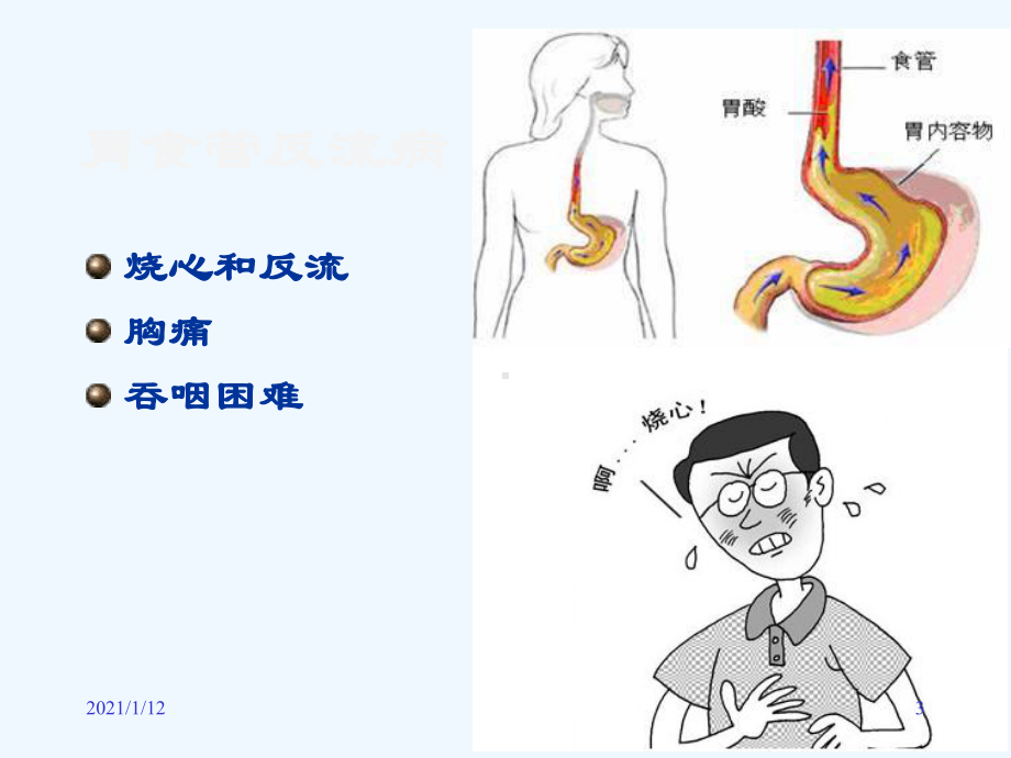 胃炎课件精华版.ppt_第3页