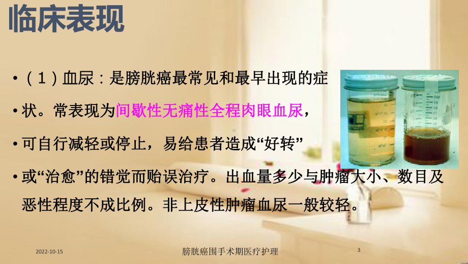 膀胱癌围手术期医疗护理培训课件.ppt_第3页