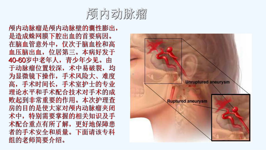 颅内动脉瘤手术配合课件.ppt_第2页