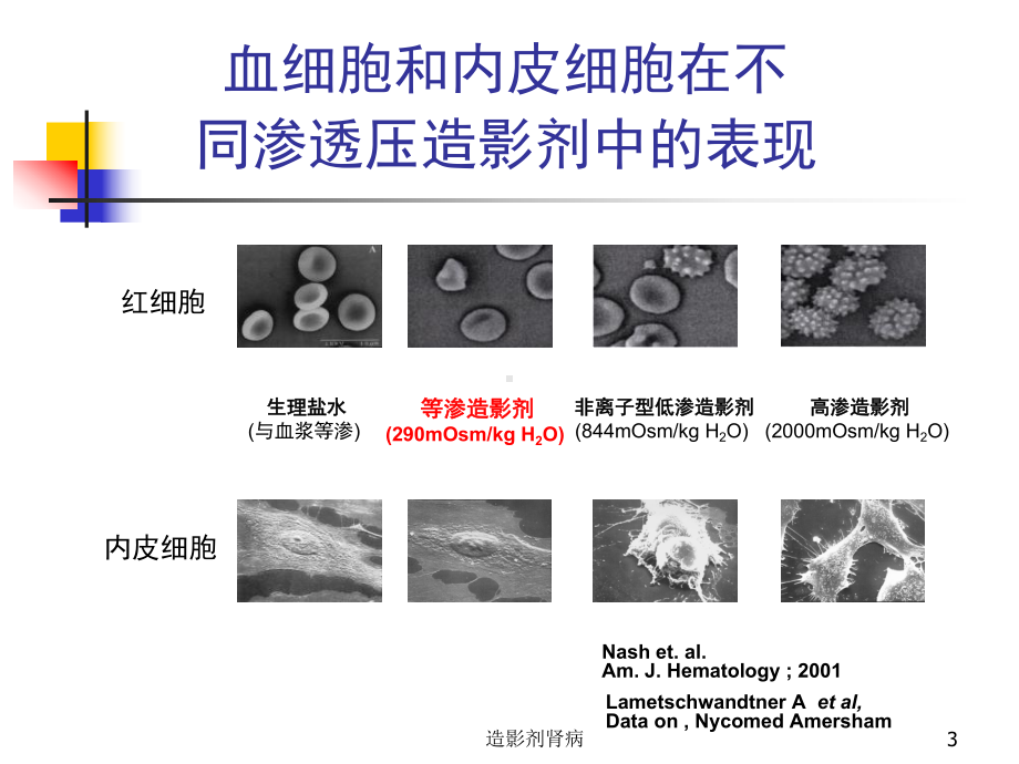 造影剂肾病课件.ppt_第3页