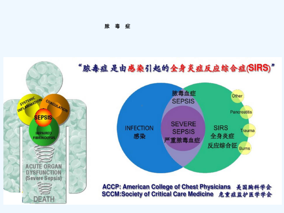 降钙素原检测临床应用课件.ppt_第2页