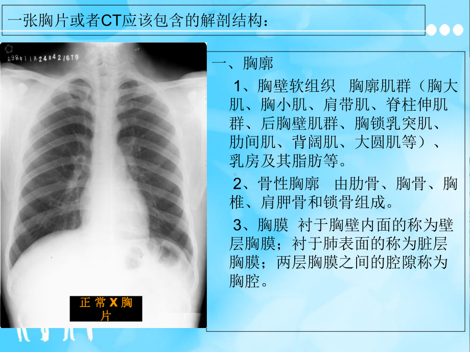 胸片及胸部CT的阅读内容及肺段定位-课件.ppt_第2页