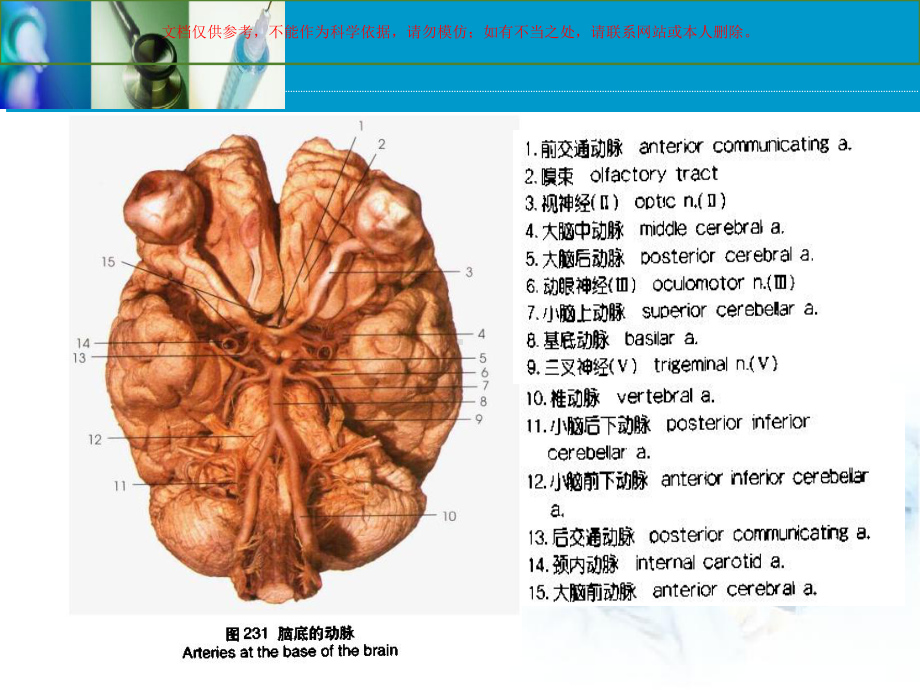 脑血管病脑出血和脑缺血培训课件.ppt_第3页