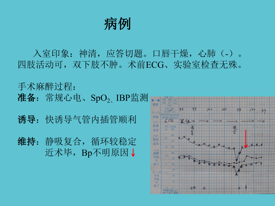 颅内动脉瘤介入栓塞术的麻醉管理课件.ppt_第3页