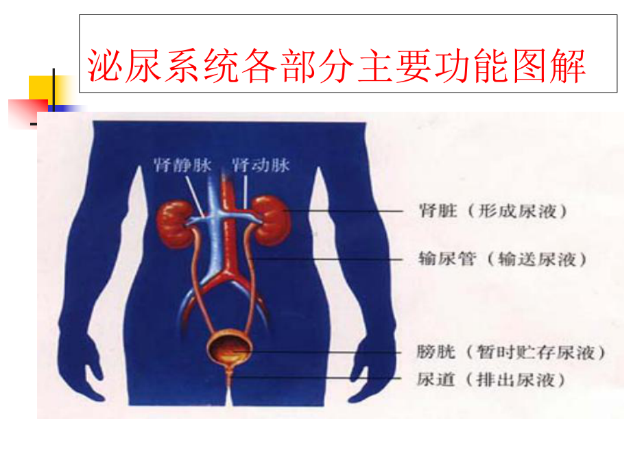 输尿管结石的护理查房课件.ppt_第3页