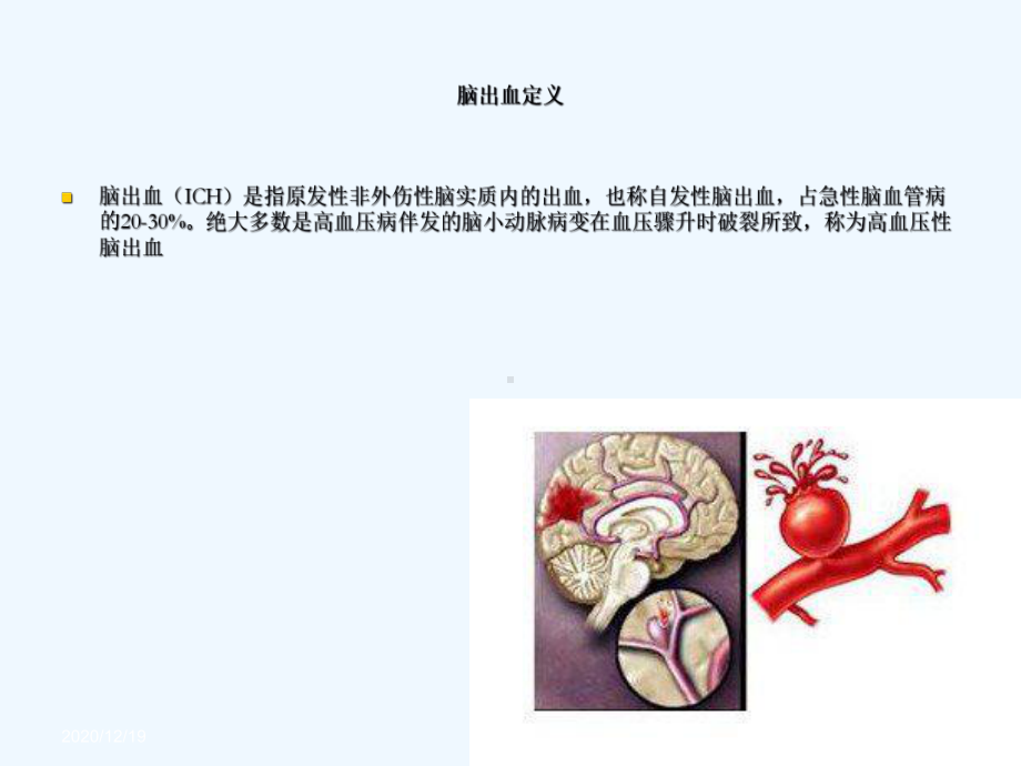 脑出血业务学习[1]课件.ppt_第3页