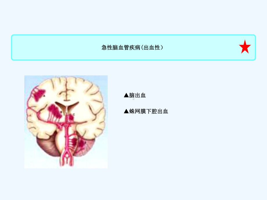 脑出血护理-课件-2.ppt_第3页