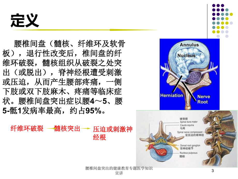 腰椎间盘突出的健康教育专题医学知识宣讲培训课件.ppt_第3页