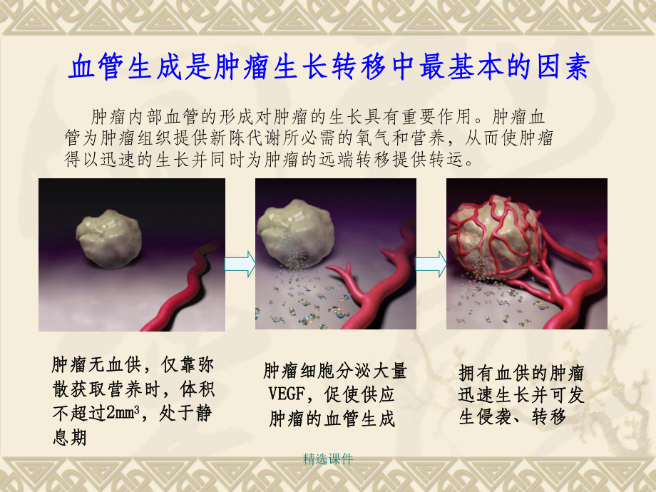 肿瘤的血管生成课件.ppt_第3页