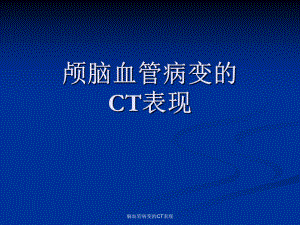 脑血管病变的CT表现课件.ppt