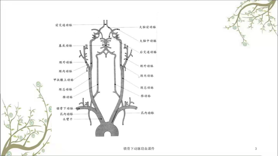 锁骨下动脉窃血课件.ppt_第3页