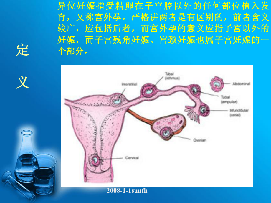 输卵管妊娠与妊娠黄体的超声鉴别诊断课件.ppt_第3页