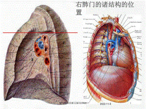 肺门和肺段断层解剖和CT培训课件.ppt