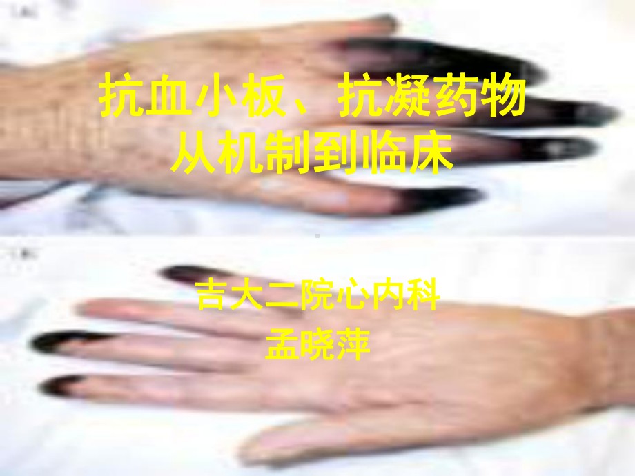 抗血小板抗凝药物从机制到临床课件.ppt_第1页