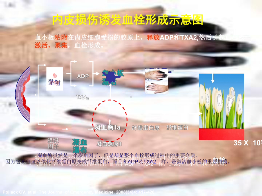 抗血小板抗凝药物从机制到临床课件.ppt_第2页