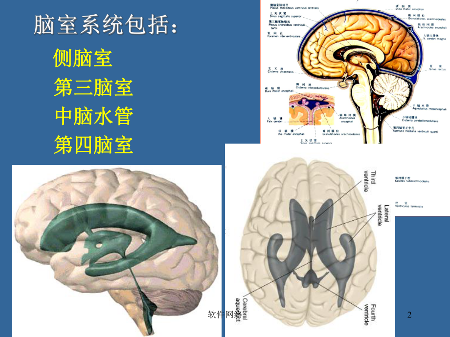 脑室断层解剖[医疗医学]课件.ppt_第2页