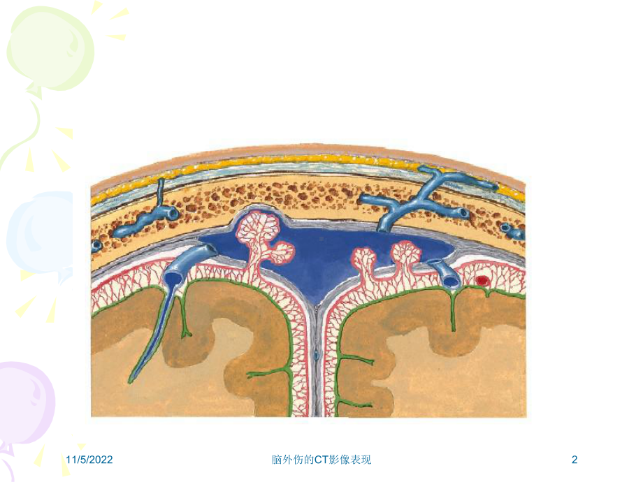 脑外伤的CT影像表现培训课件.ppt_第2页