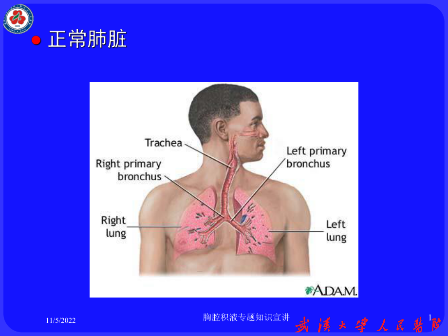 胸腔积液专题知识宣讲培训课件.ppt_第1页