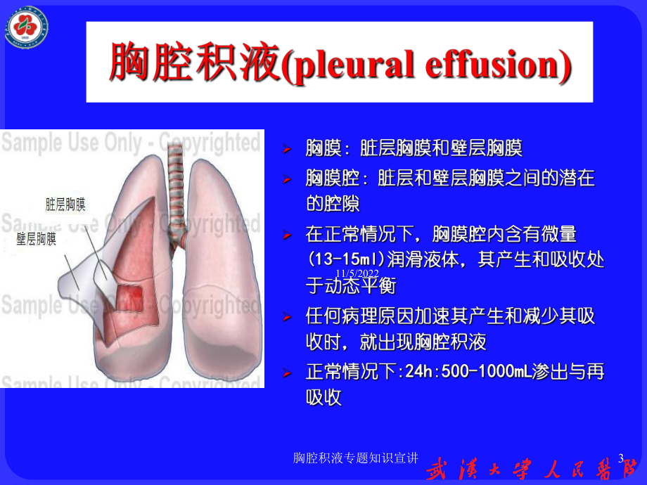 胸腔积液专题知识宣讲培训课件.ppt_第3页