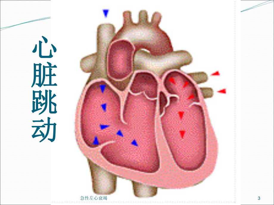 急性左心衰竭培训课件1.ppt_第3页