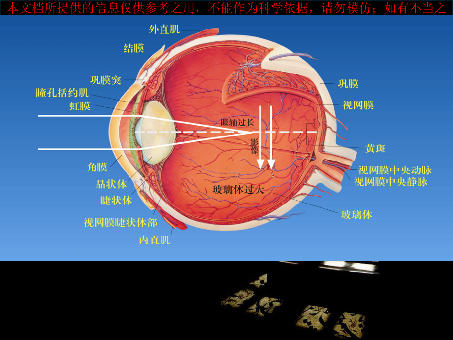 近视远视散光弱视的非传统配镜和训练培训课件.ppt_第3页