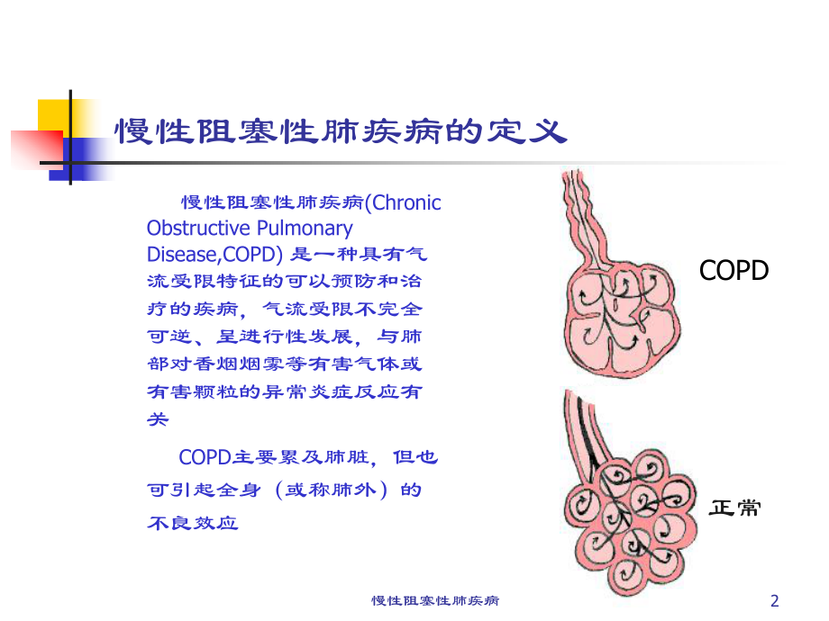 慢性阻塞性肺疾病培训课件1.ppt_第2页