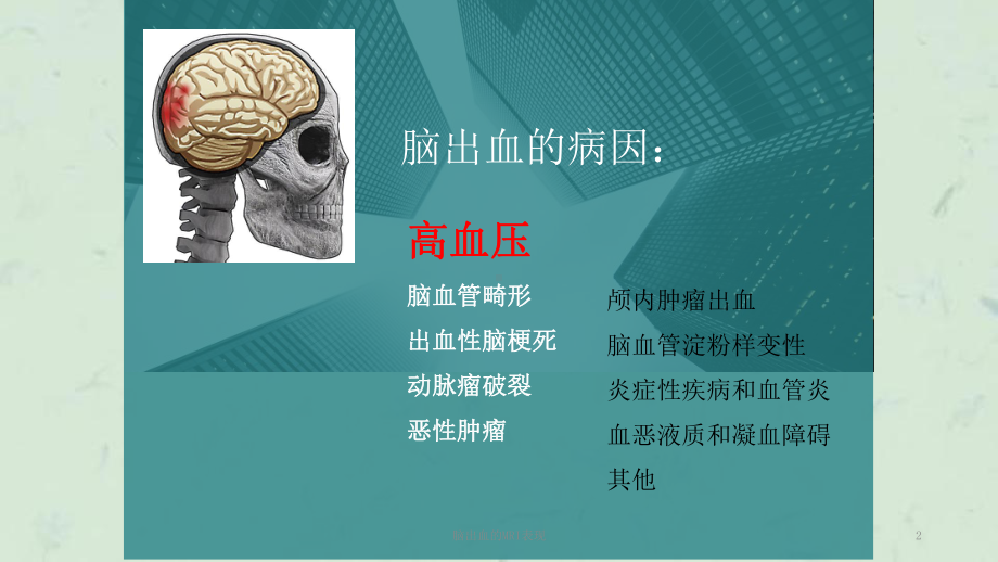 脑出血的MRI表现课件.ppt_第2页