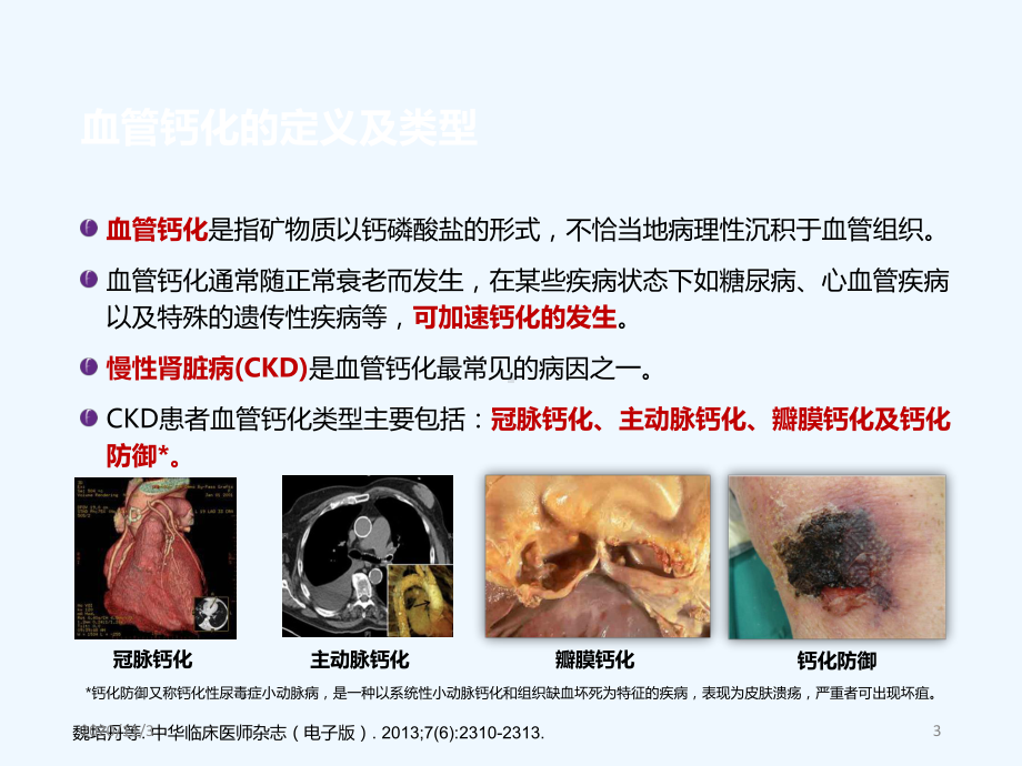 重视高磷血症的治疗防治血管钙化课件.pptx_第3页