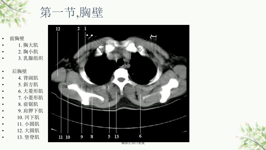 胸部正常CT表现课件.ppt_第2页