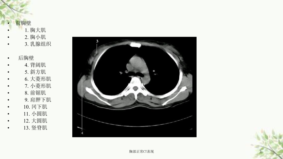 胸部正常CT表现课件.ppt_第3页