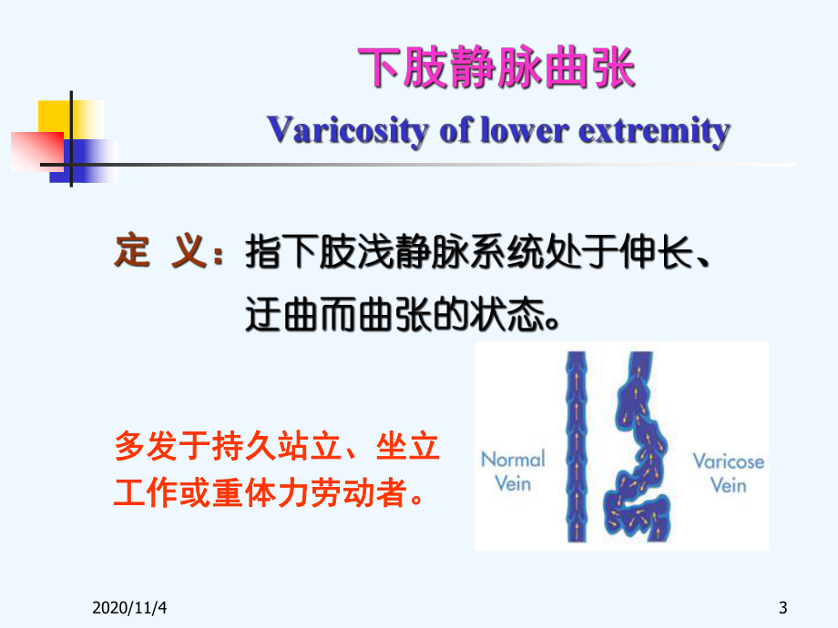 静脉曲张的相关知识和预防措施课件.ppt_第3页