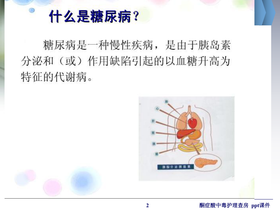 酮症酸中毒护理查房-课件.ppt_第2页