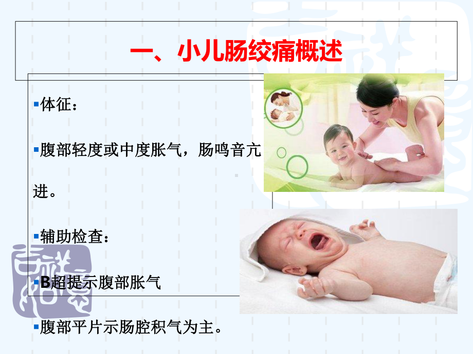 药熨法治疗小儿肠绞痛-课件.ppt_第3页