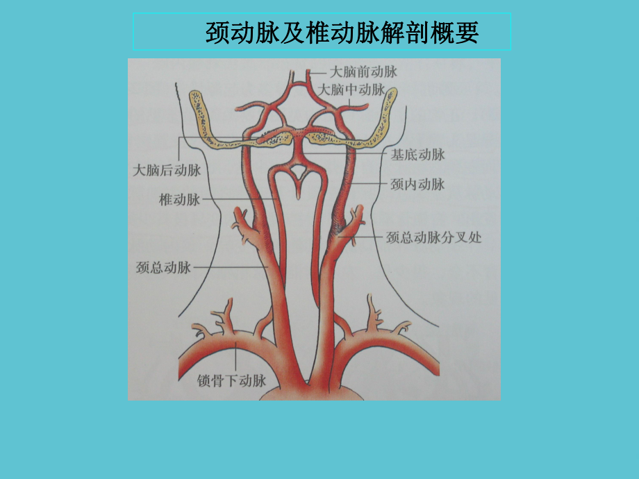 锁骨下动脉盗血课件-2.ppt_第2页