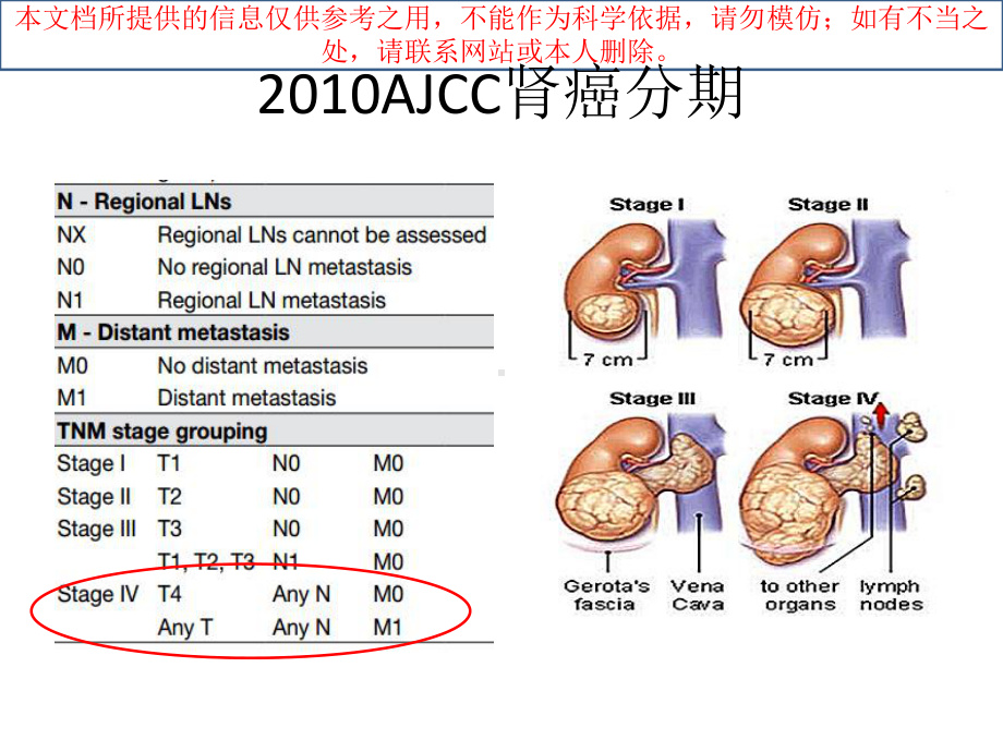 转移性肾癌靶向治疗现状和进展培训课件.ppt_第1页