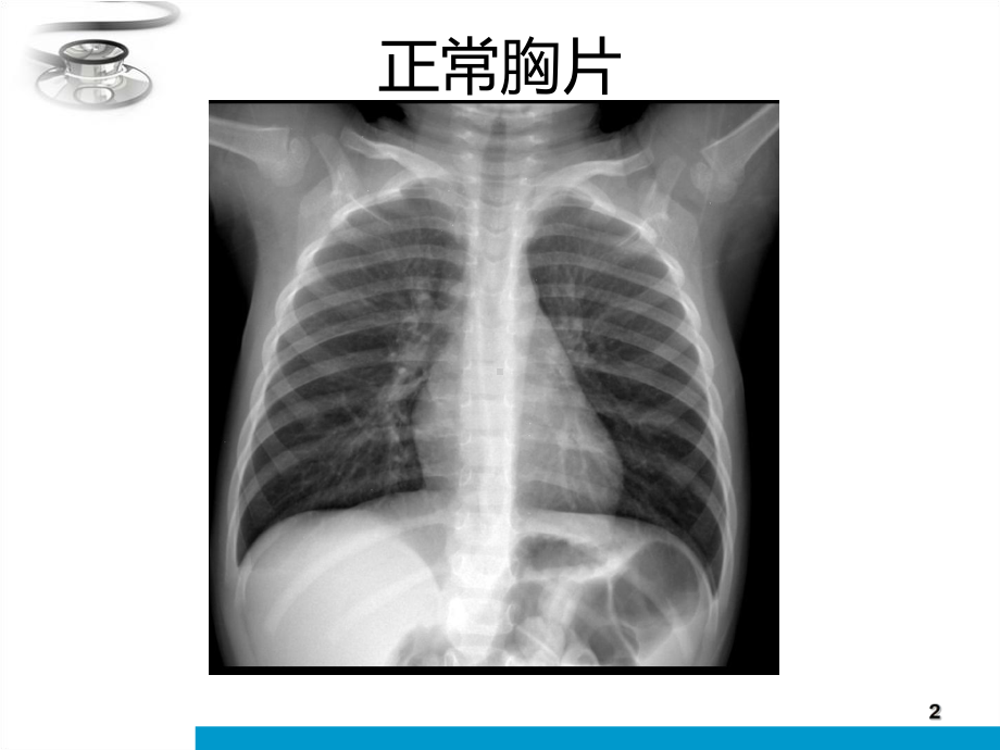 执业医师X线读片课件.ppt_第2页