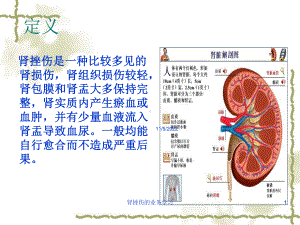 肾挫伤的业务学习培训课件.ppt