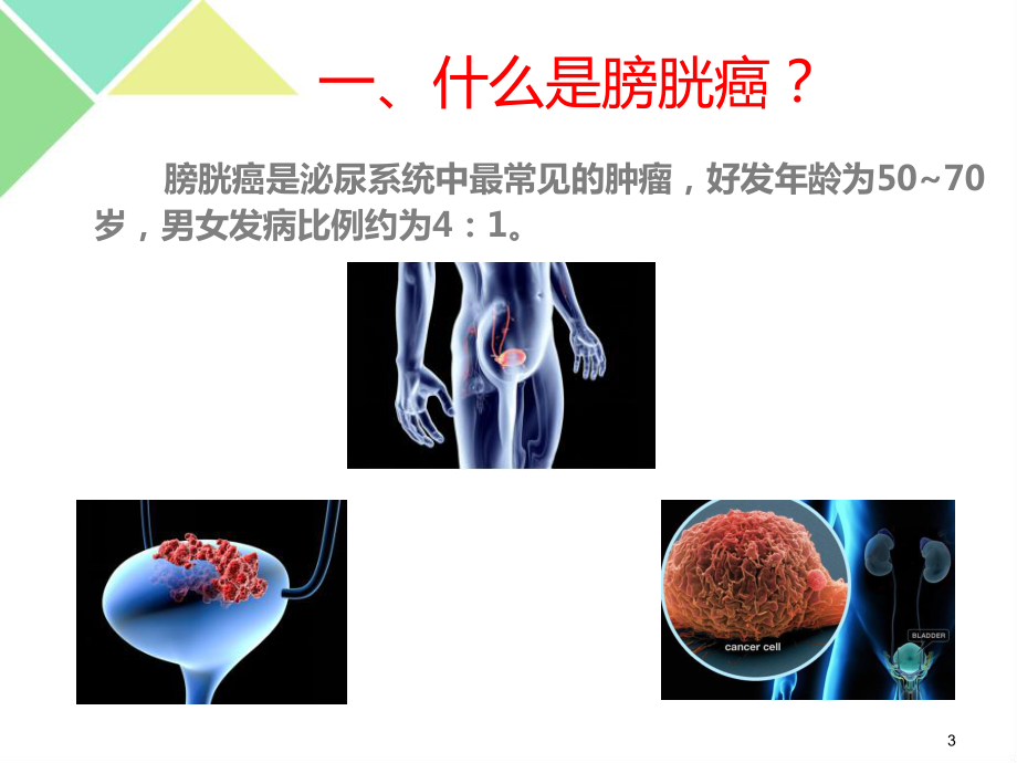 膀胱癌病人的护理课件.ppt_第3页