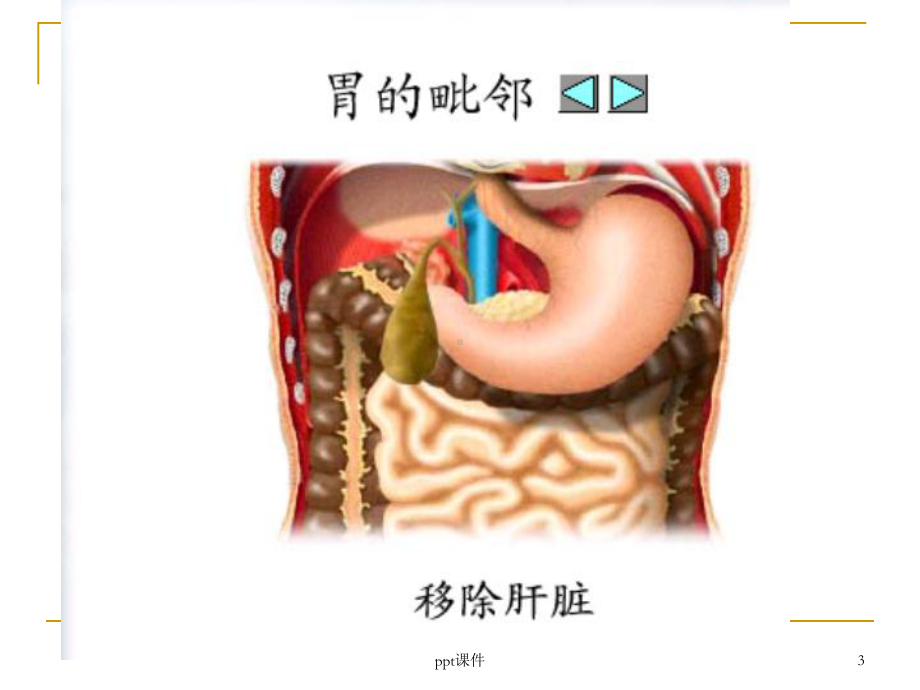 胃十二指肠疾病病人的护理-课件.ppt_第3页