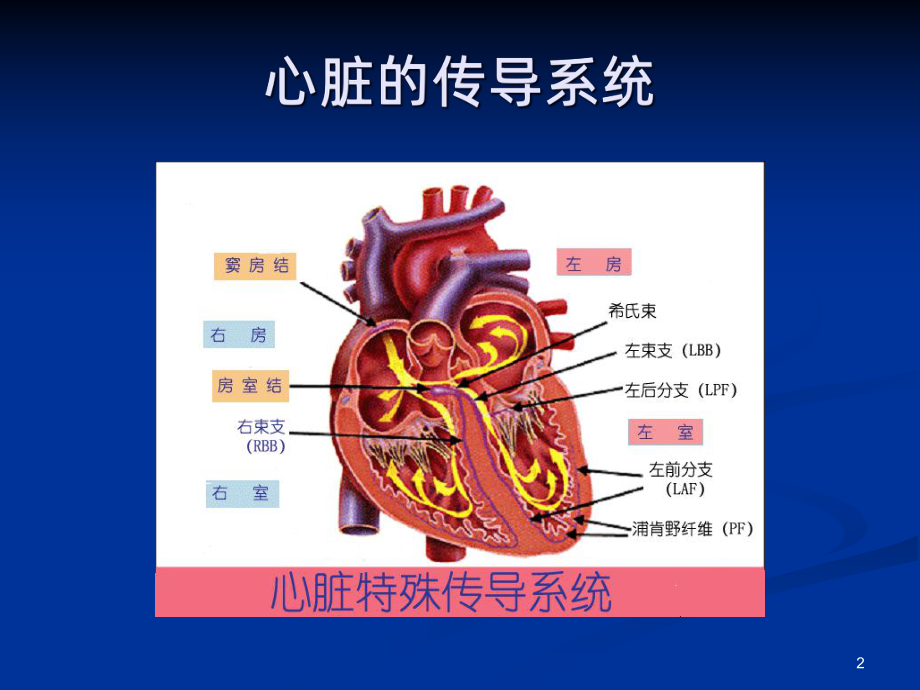 恶性心律失常的识别与护理课件.ppt_第2页