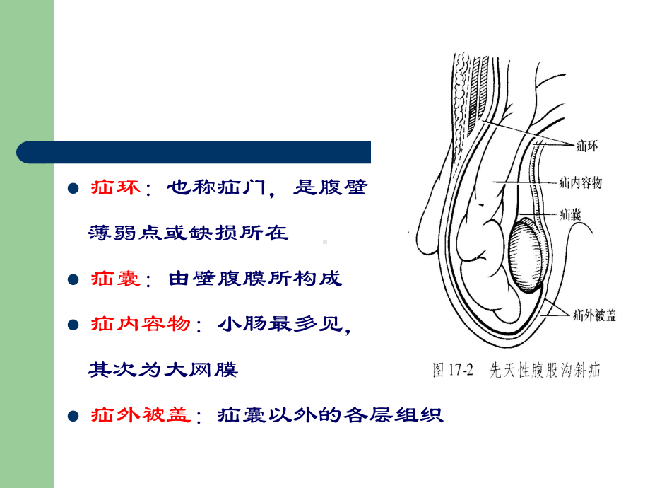 腹外疝围手术期的护理课件2.ppt_第3页