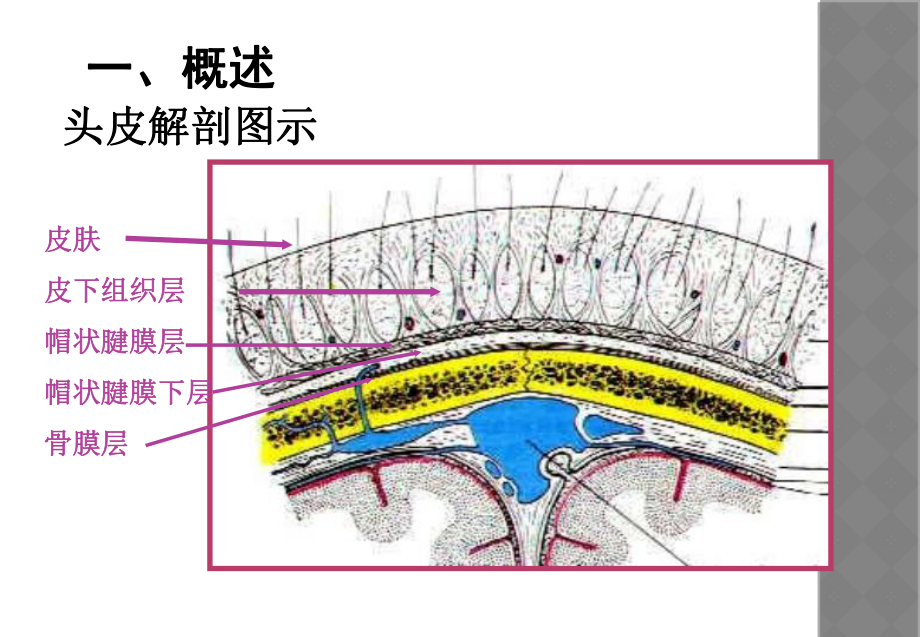 颅内压增高汇编课件.ppt_第2页