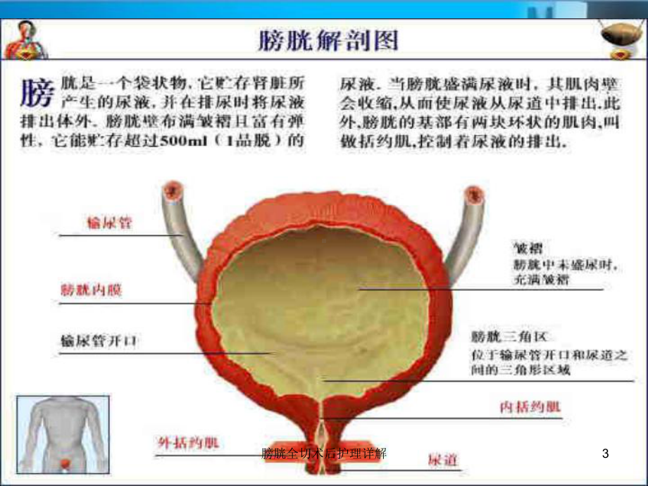 膀胱全切术后护理详解培训课件.ppt_第3页