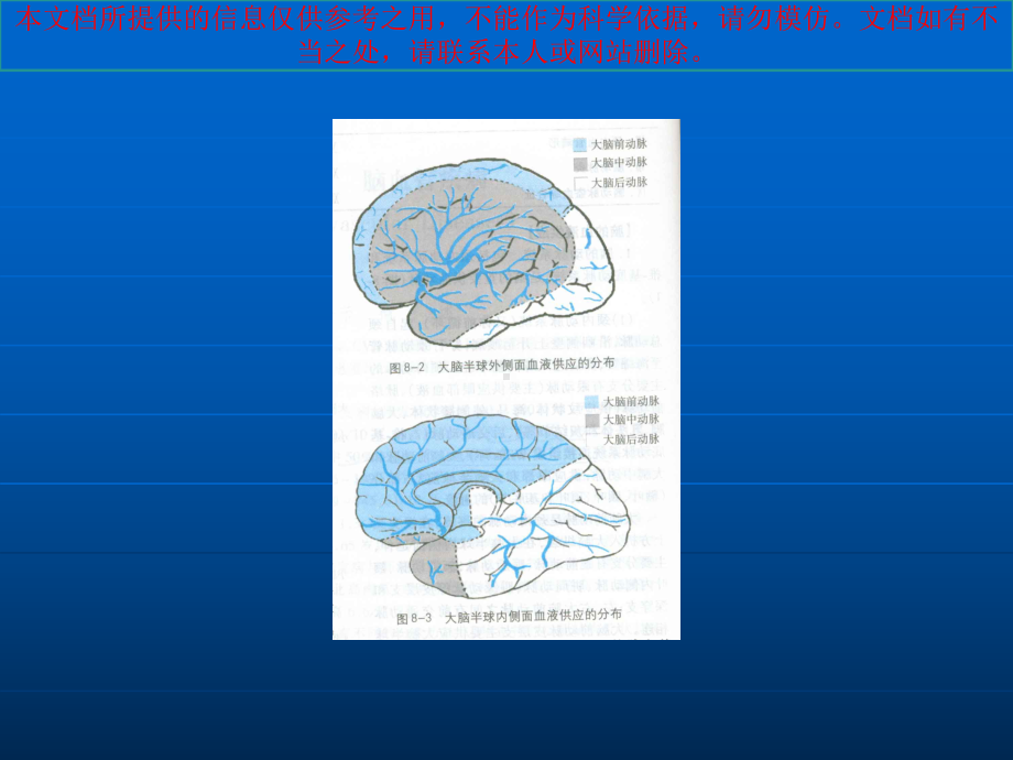 急性脑血管疾病培训课件1.ppt_第2页